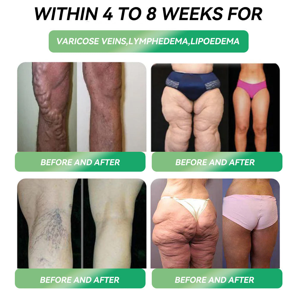 Only 10 boxes left! 🎁𝙃𝐻𝑽𝖡® score an exclusive 30% off today!  Endorsed by endocrinologists — 4 to 6 boxes recommended to keep the weight off and avoid rebound.  Last chance before the new year rolls around — don’t miss out! 🎁